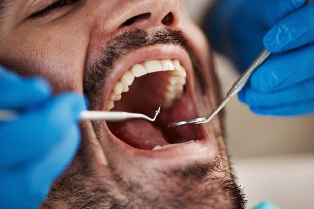Best Urgent Dental Care for Toothache in River Park, FL